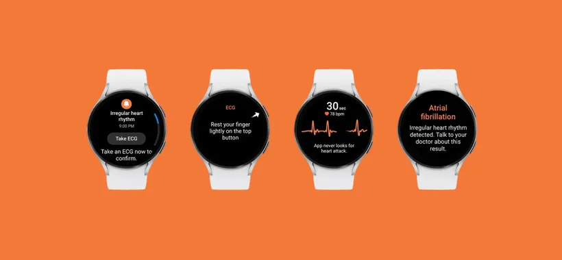 Samsung Galaxy Watch 7 sfrutterà l'AI per monitorare la salute?