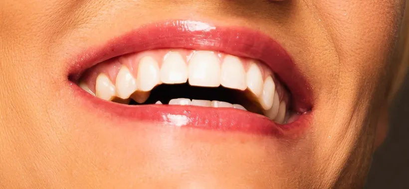 Oclean, tutti gli sconti che miglioreranno il tuo sorriso